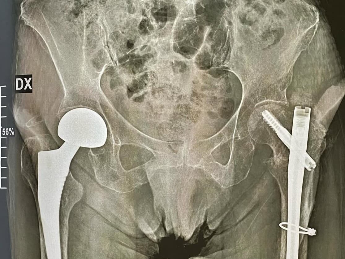 Fisioterapia a domicilio